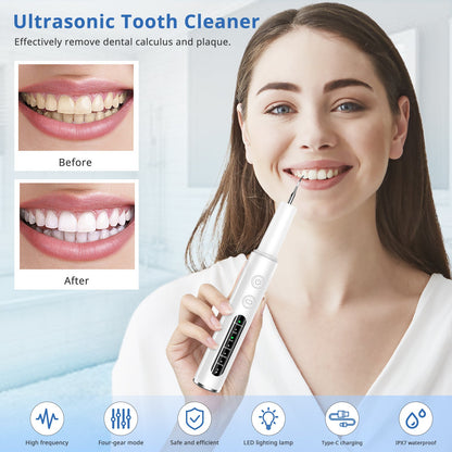 Household Charging Ultrasonic Teeth Cleaner - My Store