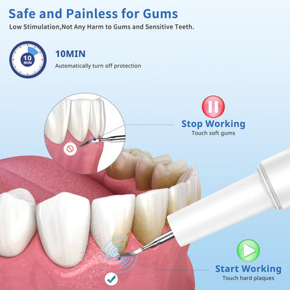 Household Charging Ultrasonic Teeth Cleaner - My Store